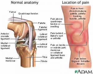 knee-pain-picture